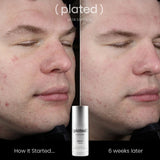 (Plated) Daily Serum