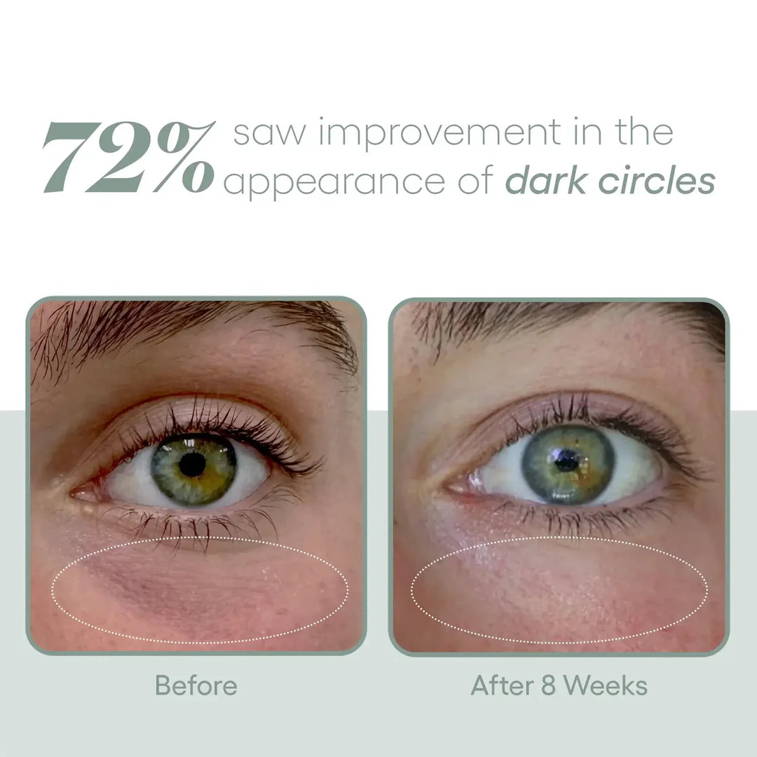 (Plated) Eye Serum