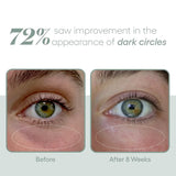 (Plated) Eye Serum