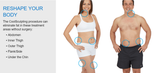 Coolsculpting Cycle